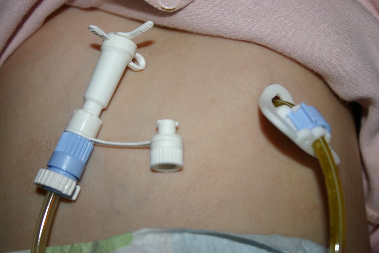 Dr. Vinit Kahalekar Gastroenterologist in Aurangabad